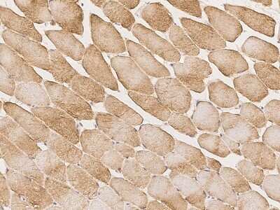 Immunohistochemistry: RAD9B Antibody [NBP3-06241] - Immunochemical staining of human RAD9B in human skeletal muscle with rabbit polyclonal antibody at 1:2000 dilution, formalin-fixed paraffin embedded sections.