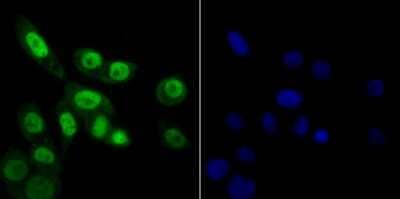 Immunocytochemistry/Immunofluorescence: RAE1 Antibody [NBP2-80421] - Staining Rae1 in LOVO cells (green). The nuclear counter stain is DAPI (blue). Cells were fixed in paraformaldehyde, permeabilized with 0.25% Triton X100/PBS.