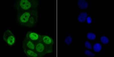 Immunocytochemistry/Immunofluorescence: RAE1 Antibody [NBP2-80421] - Staining Rae1 in MCF-7 cells (green). The nuclear counter stain is DAPI (blue). Cells were fixed in paraformaldehyde, permeabilized with 0.25% Triton X100/PBS.