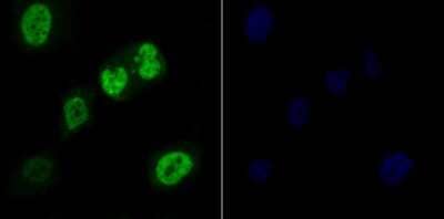 Immunocytochemistry/Immunofluorescence: RAE1 Antibody [NBP2-80421] - Staining Rae1 in PC-3M cells (green). The nuclear counter stain is DAPI (blue). Cells were fixed in paraformaldehyde, permeabilized with 0.25% Triton X100/PBS.