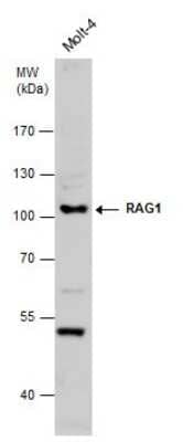 Western Blot: RAG1 Antibody [NBP3-13070] - Whole cell extract (30 ug) was separated by 7.5% SDS-PAGE, and the membrane was blotted with RAG1 antibody (NBP3-13070) diluted at 1:500.