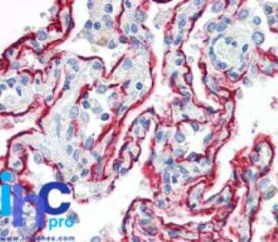 Immunohistochemistry-Paraffin: RAGE Antibody [NBP2-03951] - Human lung stained with RAGE antibody at 10 ug/ml.
