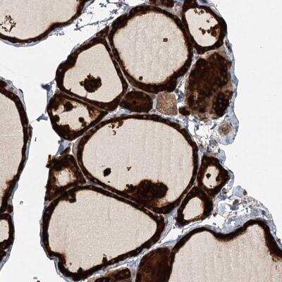 Immunohistochemistry: RAGEF2 Antibody [NBP2-46660] - Staining of human thyroid gland showing strong cytoplasmic positivity in glandular cells.