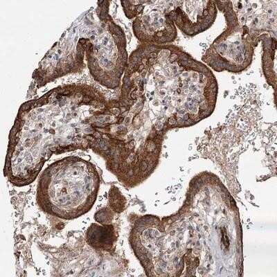 Immunohistochemistry-Paraffin: RAGEF2 Antibody [NBP1-87301] - Staining of human placenta shows strong cytoplasmic positivity in trophoblastic cells.