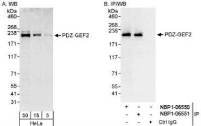 Western Blot: RAGEF2 Antibody [NBP1-06551] - Whole cell lysate from HeLa cells. PDZ-GEF2 was also immunoprecipitated by rabbit anti-PDZ-GEF2 antibody NBP1-06550.