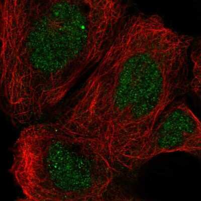 <b>Independent Antibodies Validation. </b>Immunocytochemistry/Immunofluorescence: RAI14 Antibody [NBP1-94076] - Staining of human cell line A-431 shows localization to nucleus & cytosol. Antibody staining is shown in green.