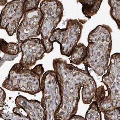 Immunohistochemistry-Paraffin: RAI14 Antibody [NBP1-94075] - Staining of human placenta shows strong cytoplasmic and membranous positivity in trophoblastic cells.