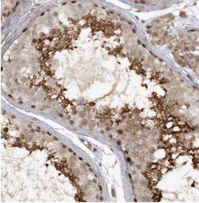 Immunohistochemistry-Paraffin: RAI14 Antibody [NBP1-94075] - Staining of human testis shows strong cytoplasmic and membranous positivity in cells in seminiferous ducts.