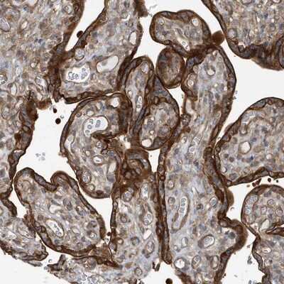 Immunohistochemistry-Paraffin: RAI14 Antibody [NBP1-94076] - Staining of human placenta shows strong membrane and cytoplasmic positivity in trophoblastic cells.