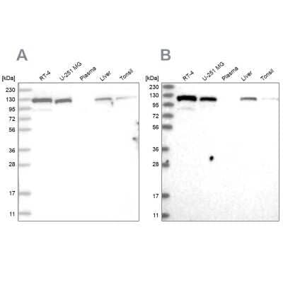 Western Blot RAI14 Antibody - BSA Free