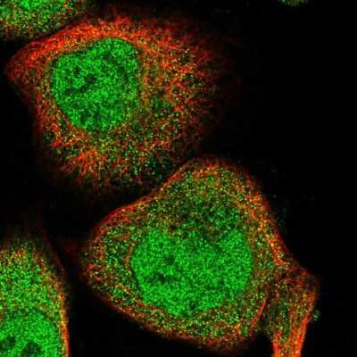 Immunocytochemistry/Immunofluorescence: RAI16 Antibody [NBP1-92313] - Immunofluorescent staining of human cell line A-431 shows localization to nucleoplasm & cytosol.