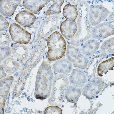 Immunohistochemistry-Paraffin: RAI16 Antibody [NBP3-15604] - Immunohistochemistry of paraffin-embedded mouse kidney using RAI16 Rabbit pAb (NBP3-15604) at dilution of 1:100 (40x lens).Perform high pressure antigen retrieval with 10 mM citrate buffer pH 6.0 before commencing with IHC staining protocol.