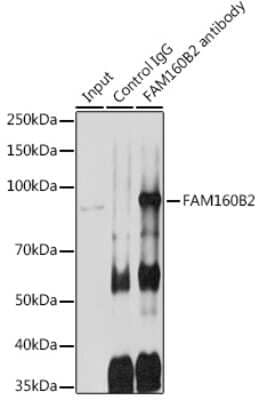 Immunoprecipitation: RAI16 Antibody [NBP3-15604] - Immunoprecipitation analysis of 600ug extracts of Rat testis cells using 3ug RAI16 antibody (NBP3-15604). Western blot was performed from the immunoprecipitate using RAI16 antibody (NBP3-15604) at a dilition of 1:1000.