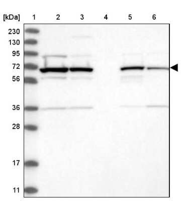 Western Blot: RAI16 Antibody [NBP1-92313] - Lane 1: Marker  [kDa] 230, 130, 95, 72, 56, 36, 28, 17, 11.  Lane 2: Human cell line RT-4.  Lane 3: Human cell line U-251MG sp.  Lane 4: Human plasma (IgG/HSA depleted).  Lane 5: Human liver tissue.  Lane 6: Human tonsil tissue