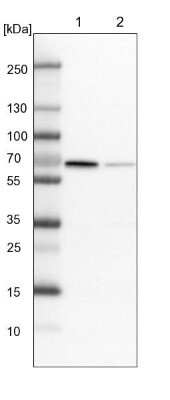 Western Blot RAI16 Antibody - BSA Free