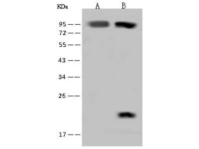 Western Blot: RAI16 Antibody [NBP2-97743] - Anti-RAI16 rabbit polyclonal antibody at 1:500 dilution. Lane A: U-251 MG Whole Cell Lysate. Lysates/proteins at 30 ug per lane. Secondary Goat Anti-Rabbit IgG (H+L)/HRP at 1/10000 dilution. Developed using the ECL technique. Performed under reducing conditions. Predicted band size: 82 kDa. Observed band size: 90 kDa