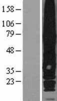 Western Blot GPRC5A/RAI3 Overexpression Lysate