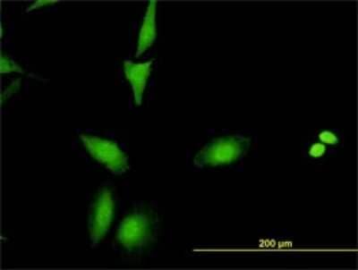 Immunocytochemistry/Immunofluorescence: RAIDD/CRADD Antibody (1F8) [H00008738-M01] - Analysis of monoclonal antibody to CRADD on HeLa cell. Antibody concentration 10 ug/ml.