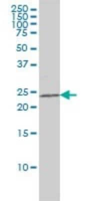 Western Blot: RAIDD/CRADD Antibody (1F8) [H00008738-M01] - CRADD monoclonal antibody (M01), clone 1F8 Analysis of CRADD expression in K-562.