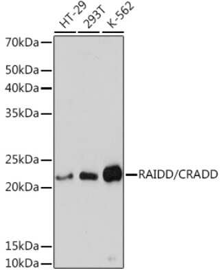 Western Blot: RAIDD/CRADD Antibody (3Z9N8) [NBP3-16672] - Western blot analysis of extracts of various cell lines, using RAIDD/CRADD Rabbit mAb (NBP3-16672) at 1:3000 dilution. Secondary antibody: HRP Goat Anti-Rabbit IgG (H+L) at 1:10000 dilution. Lysates/proteins: 25ug per lane. Blocking buffer: 3% nonfat dry milk in TBST. Detection: ECL Basic Kit. Exposure time: 30s.