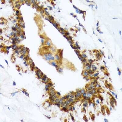 Immunohistochemistry-Paraffin: RAIDD/CRADD Antibody (7M7M6) [NBP3-16673] - Immunohistochemistry of paraffin-embedded human breast using RAIDD/CRADD Rabbit mAb (NBP3-16673) at dilution of 1:100 (40x lens).Perform microwave antigen retrieval with 10 mM Tris/EDTA buffer pH 9.0 before commencing with IHC staining protocol.