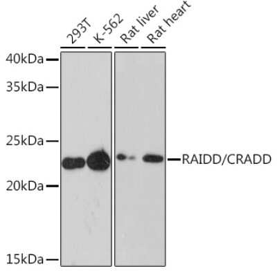 Western Blot: RAIDD/CRADD Antibody (7M7M6) [NBP3-16673] - Western blot analysis of extracts of various cell lines, using RAIDD/CRADD Rabbit mAb (NBP3-16673) at 1:1000 dilution. Secondary antibody: HRP Goat Anti-Rabbit IgG (H+L) at 1:10000 dilution. Lysates/proteins: 25ug per lane. Blocking buffer: 3% nonfat dry milk in TBST. Detection: ECL Enhanced Kit. Exposure time: 3min.