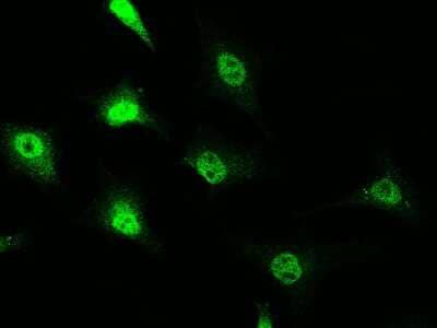 Immunocytochemistry/Immunofluorescence: RAIDD/CRADD Antibody [NBP3-00051] - Immunofluorescence staining of RAIDD/CRADD in HeLa cells. Cells were fixed with 4% PFA, permeabilzed with 0.3% Triton X-100 in PBS, blocked with 10% serum, and incubated with rabbit anti-human RAIDD/CRADD polyclonal antibody (1:5000) at 4C overnight. Then cells were stained with the Alexa Fluor(R)488-conjugated Goat Anti-rabbit IgG Secondary antibody (green).Positive staining was localized to cytoplasm and nucleus.