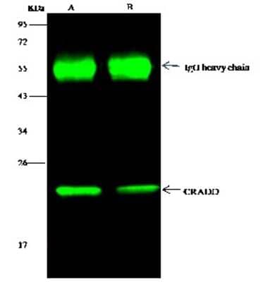 Immunoprecipitation: RAIDD/CRADD Antibody [NBP3-00051] - RAIDD/CRADD was immunoprecipitated using: Lane A: 0.5 mg K562 Whole Cell Lysate. Lane B: 0.5 mg Hela Whole Cell Lysate. 1 ul anti-RAIDD/CRADD rabbit polyclonal antibody and 15 ul of 50 % Protein G agarose. Primary antibody: Anti-RAIDD/CRADD rabbit polyclonal antibody, at 1:500 dilution. Secondary antibody: Dylight 800-labeled antibody to rabbit IgG (H+L), at 1:5000 dilution. Developed using the Odyssey technique. Performed under reducing conditions. Predicted band size: 23 kDa. Observed band size: 23 kDa