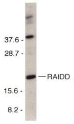 Western Blot: RAIDD/CRADD Antibody [NBP1-77048] - HeLa total cell lysate with RAIDD antibody at 1 ug/ml.