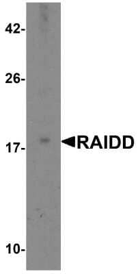 Western Blot: RAIDD/CRADD Antibody [NBP1-77048] - Analysis of RAIDD in MCF7 total cell lysate with RAIDD antibody at 2 ug/mL.