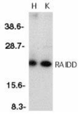 Western Blot: RAIDD/CRADD Antibody [NBP1-77061] - Whole cell lysates from HeLa (H) or K562 (K) cells with RAIDD antibody at 1:500 dilution.