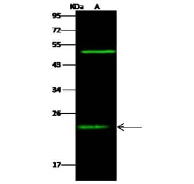 Western Blot: RAIDD/CRADD Antibody [NBP3-00051] - Anti-RAIDD/CRADD rabbit polyclonal antibody at 1:500 dilution. Lane A: K562 Whole Cell Lysate. Lysates/proteins at 30 ug per lane. Secondary Goat Anti- Rabbit  IgG H&L (Dylight 800)  at 1/10000 dilution. Developed using the Odyssey technique. Performed under reducing conditions. Predicted band size: 23 kDa. Observed band size: 23 kDa (We are unsure as to the identity of these extra bands).