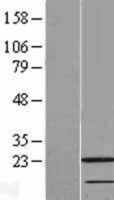 Western Blot RAIDD/CRADD Overexpression Lysate