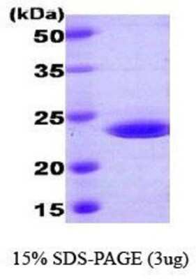 SDS-PAGE Recombinant Human RAIDD/CRADD His Protein