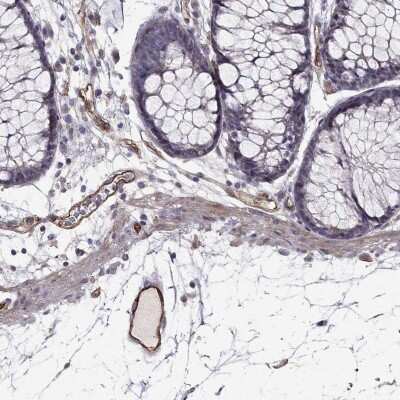 Immunohistochemistry: RAIN Antibody [NBP2-69033] - Immunohistochemical staining of human colon shows strong cytoplasmic positivity in endothelial cells.