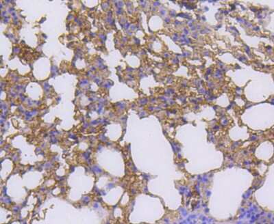 Immunohistochemistry-Paraffin: RALBP1 Antibody (SC06-49) [NBP2-67633] - Analysis of paraffin-embedded mouse lung tissue using anti-RALBP1 antibody. Counter stained with hematoxylin.