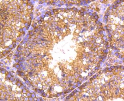 Immunohistochemistry-Paraffin: RALBP1 Antibody (SC06-49) [NBP2-67633] - Analysis of paraffin-embedded mouse testis tissue using anti-RALBP1 antibody. Counter stained with hematoxylin.