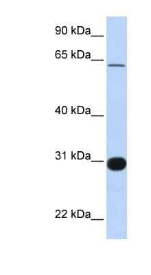 Western Blot: RALGPS1 Antibody [NBP1-58314] - Human Brain lysate, concentration 0.2-1 ug/ml.