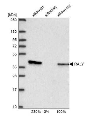 <b>Genetic Strategies Validation. </b>Western Blot: RALY Antibody [NBP2-13201] - Analysis in U2OS cells transfected with control siRNA, target specific siRNA probe #1 and #2, using anti-RALY antibody. Remaining relative intensity is presented.