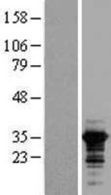 Western Blot: RALY Overexpression Lysate (Adult Normal) [NBL1-15134] Left-Empty vector transfected control cell lysate (HEK293 cell lysate); Right -Over-expression Lysate for RALY.