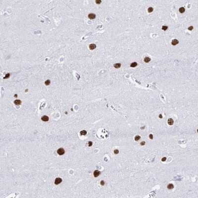 <b>Orthogonal Strategies Validation. </b>Immunohistochemistry-Paraffin: RALYL Antibody [NBP2-33768] - Staining of human cerebral cortex shows strong nuclear positivity in neuronal cells.