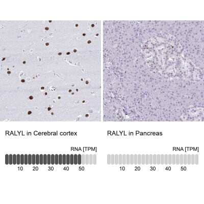 Immunohistochemistry-Paraffin RALYL Antibody