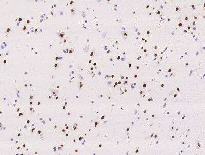 Immunohistochemistry-Paraffin: RALYL Antibody [NBP3-05925] - Staining of human RALYL in human brain with rabbit polyclonal antibody at 1:500 dilution.