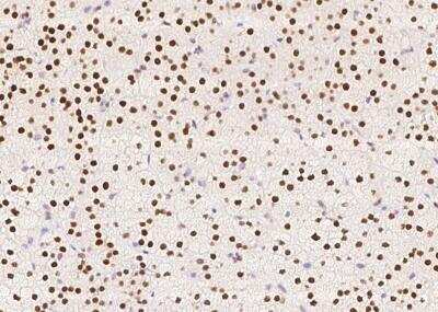 Immunohistochemistry-Paraffin: RALYL Antibody [NBP3-05925] - Staining of human RALYL in human adrenal gland with rabbit polyclonal antibody at 1:500 dilution.