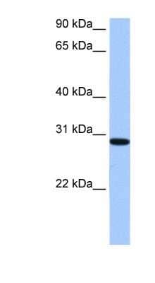 Western Blot: RALYL Antibody [NBP1-80484] - HepG2 cell lysate, concentration 0.2-1 ug/ml.