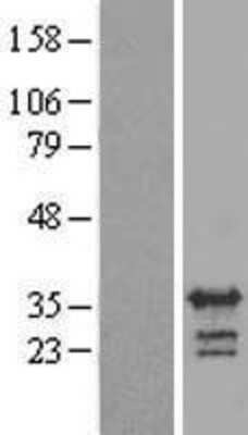 Western Blot: RALYL Overexpression Lysate (Adult Normal) [NBP2-08251] Left-Empty vector transfected control cell lysate (HEK293 cell lysate); Right -Over-expression Lysate for RALYL.