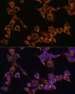 Immunocytochemistry/Immunofluorescence: RAMP1 Antibody [NBP2-94078] - Analysis of NIH/3T3 cells using RAMP1 at dilution of 1:100. Blue: DAPI for nuclear staining.