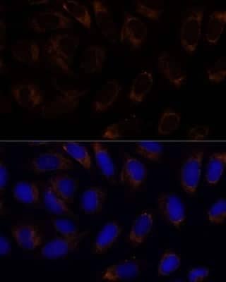 Immunocytochemistry/Immunofluorescence: RAMP1 Antibody [NBP2-94078] - Analysis of U-2 OS cells using RAMP1 at dilution of 1:100. Blue: DAPI for nuclear staining.