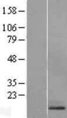 Western Blot: RAMP1 Overexpression Lysate (Adult Normal) [NBL1-15136] Left-Empty vector transfected control cell lysate (HEK293 cell lysate); Right -Over-expression Lysate for RAMP1.