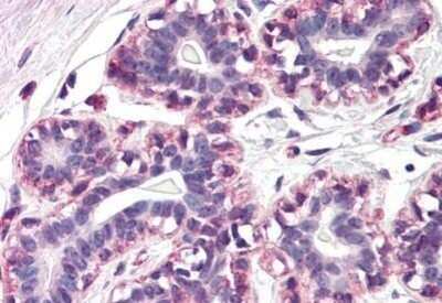 Immunohistochemistry-Paraffin: RAMP3 Antibody [NBP1-39782] - Analysis of anti-RAMP3 antibody with human breast at concentration 20 ug/ml.